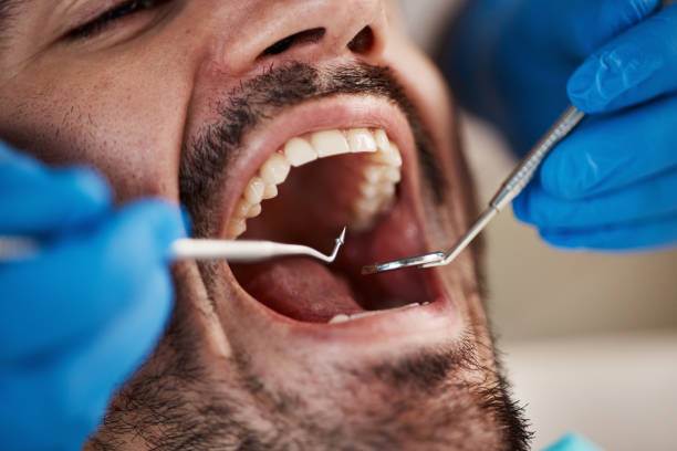 Best Root Canal Emergency Dentist  in Konterra, MD